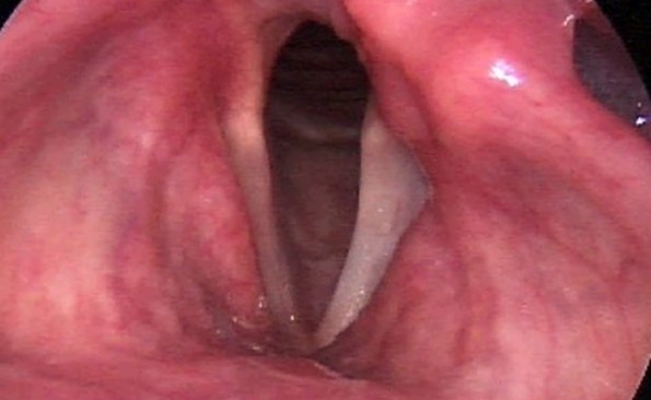 29a